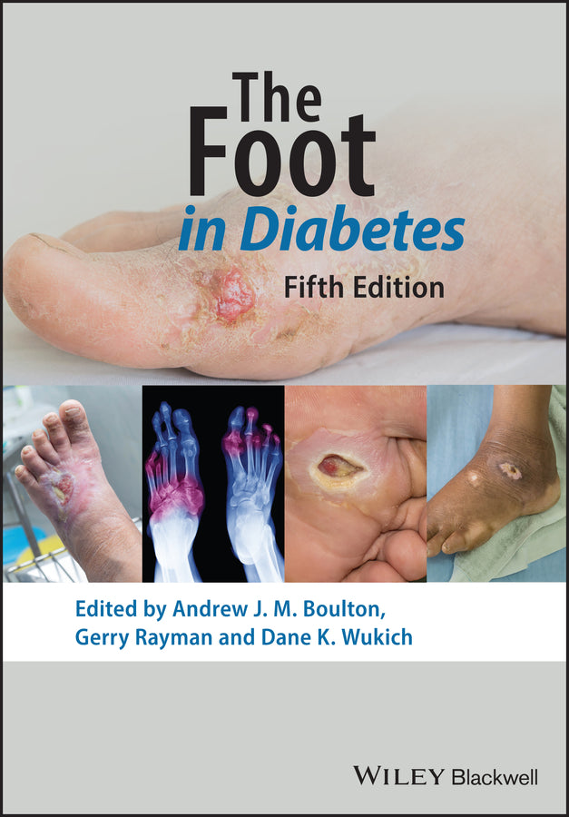 The Foot in Diabetes