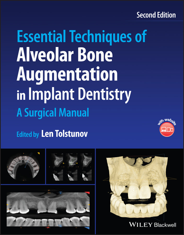 Essential Techniques of Alveolar Bone Augmentation in Implant Dentistry